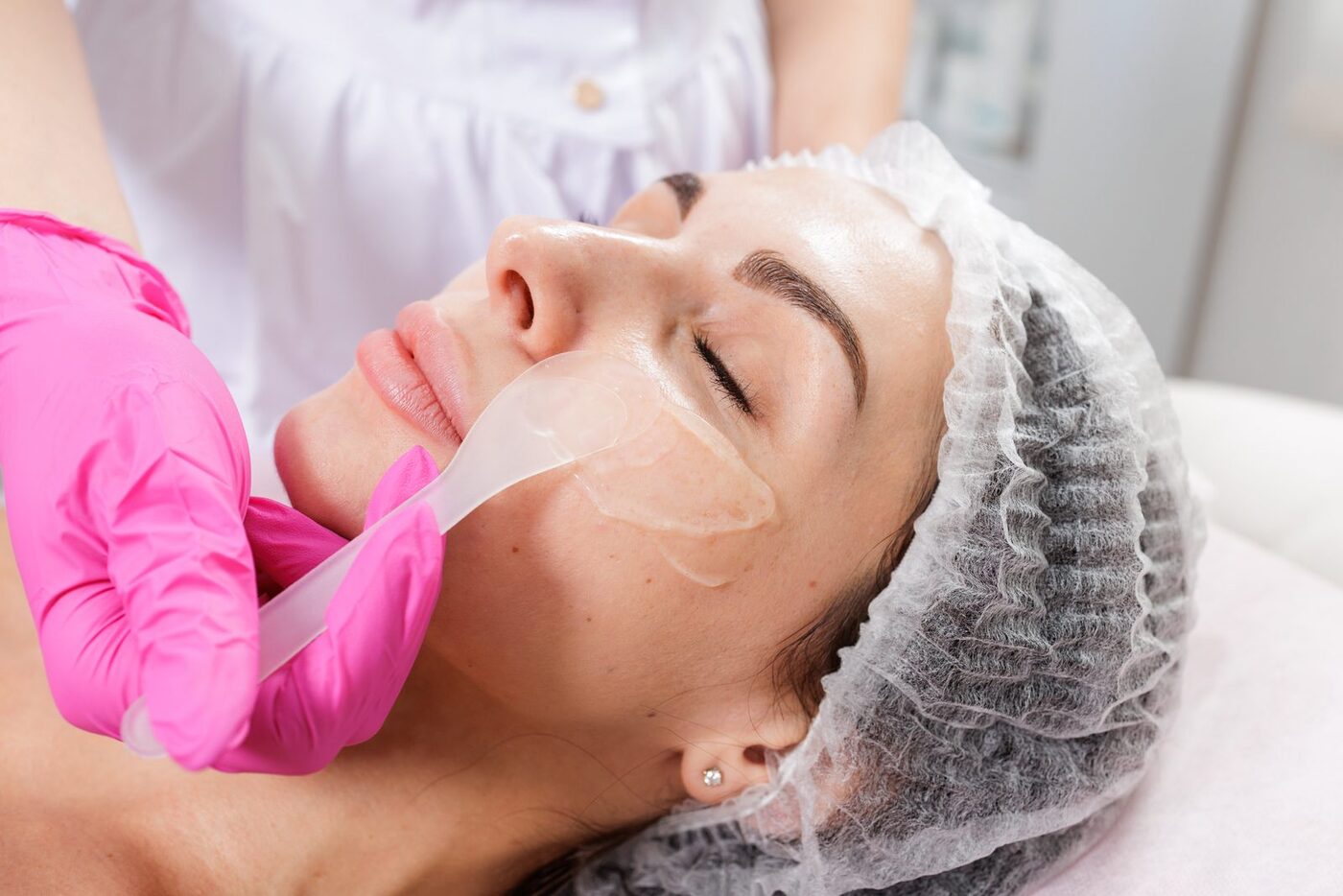 Peeling químico facial en LUMIÈRE Zaragoza